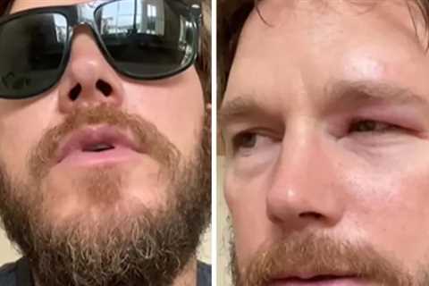 Chris Pratt Reveals Swollen Eye After Being Inspired By 'Bee Lady': 'F--k That'