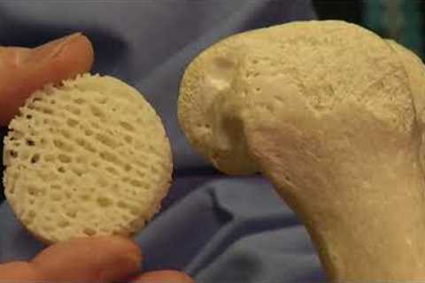 5 REMEDIES FOR RHEUMATOID ARTHRITIS