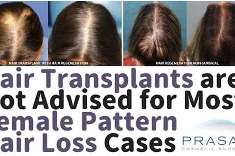 Female Pattern Hair Loss - Why Hair Transplants are not Advised in Majority of Cases