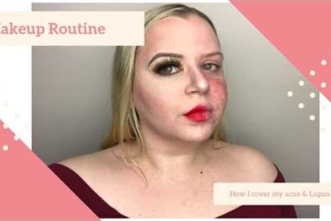 Makeup Tutorial for Covering Facial Redness, Acne and Lupus