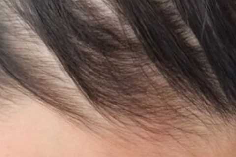 Want More Voluminous Hair? Our Top Finds This Year To Help Treat Hair Loss, Thinning, And Flat..