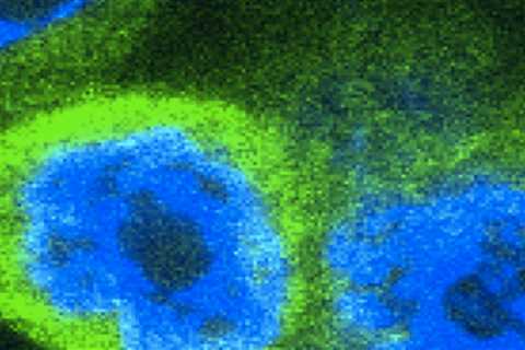 Surprise! A newly developed alarm molecule is responsible for inducing inflammation
