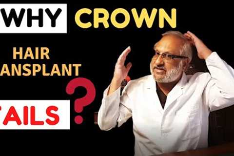 Why CROWN / vertex hair transplants FAIL? | GRADE 6  | India