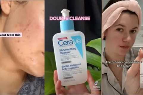 TIKTOK ACNE HACKS | Best Skincare Routines tiktok compilation