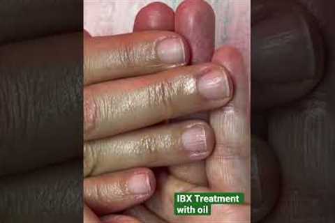 Peeling nails after CND Shellac. What's next?