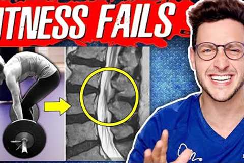 Worst Fitness Mistakes My Patients Make
