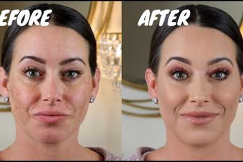 FULL COVERAGE MAKEUP FOR MELASMA &amp; HYPERPIGMENTATION (pregnant foundation routine)