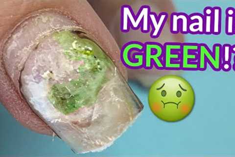 She Used Nail Glue And THIS is What Happened 🤢  | Melodysusie E-file Review