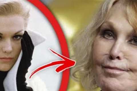 50 Celebrities Unrecognizable after Plastic Surgery