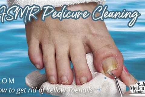 👣ASMR Pedicure Cleaning💆‍♀️How to get rid of Yellow Toenails👣