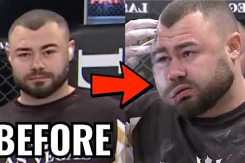 Drooping Face After Slap Fighting Victory - Doctor Explains