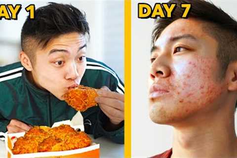 Only Eating Foods that GUARANTEE ACNE for 7 Days Straight