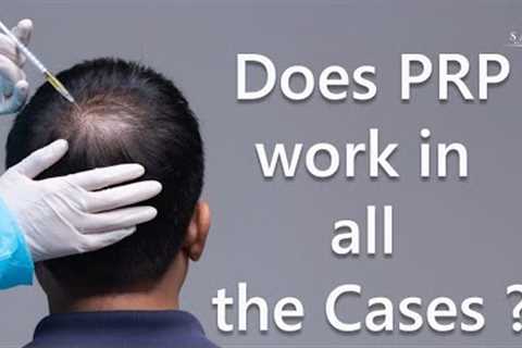 PRP | How many PRP sessions are needed for Hair Growth? PRP Hair | PRP Hair Cost | PRP Result| Satya