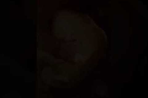 Embryonic Development In Mother's Womb 👶 ❤ 💕 Fetus Growing in Moms Tummy 👶❤💞