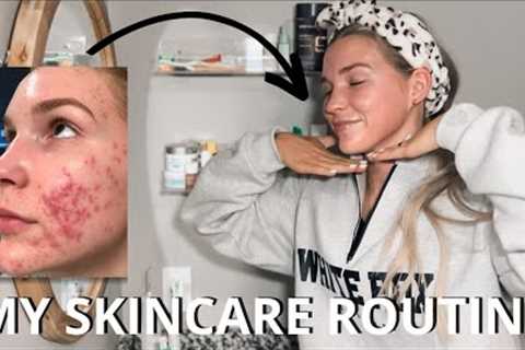 REALISTIC SKINCARE ROUTINE | MY ACCUTANE JOURNEY | OVERCOMING CYSTIC ACNE