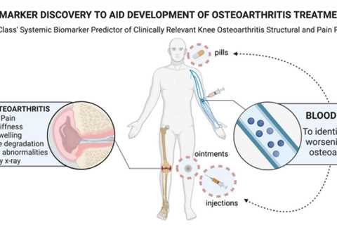 New blood tests are more precise in identifying osteoarthritis progression