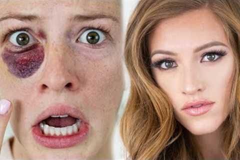 BLACK EYE to BEAUTIFUL - Cover Up Makeup Tutorial
