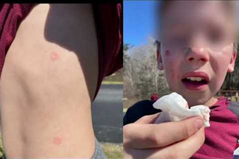 Dangerous social media trend: Police warning public of new ‘Orbeez challenge’