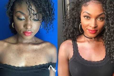 How to Cover Acne Scars with Out Foundation ( for all shades)