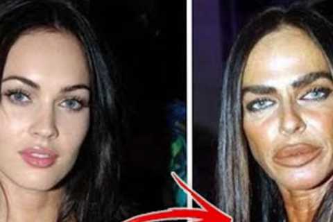Hollywood's Top Ten Worst Botched Plastic Surgery