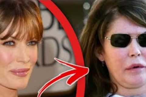Celebrities who have lost their careers through plastic surgery: Top 10