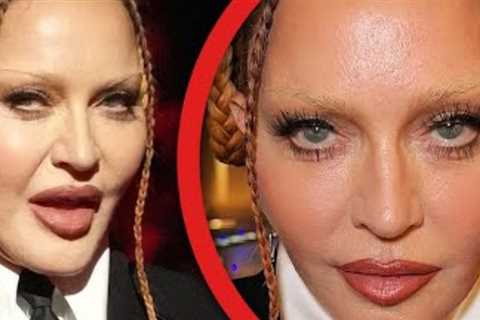 The Top 20 Celebrity Transformations that Shocked Everybody