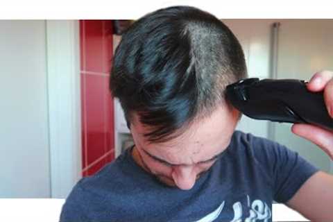 Shaving My (Transplanted) Hair. And this is how it looks like...