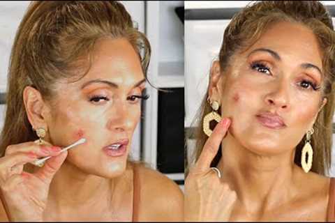 HOW TO COVER + HEAL SCABS  | BURNS  | BLEMISHES