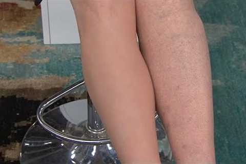 Your makeup guide to flawlessly cover veins and scars