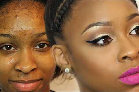 How To Cover Acne Scars and Bumps| MAKEOVER MONDAY Makeup + Hair EP.1