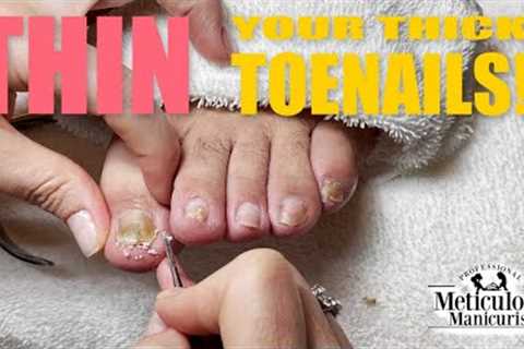 👣Thick Toenails Remedy👣