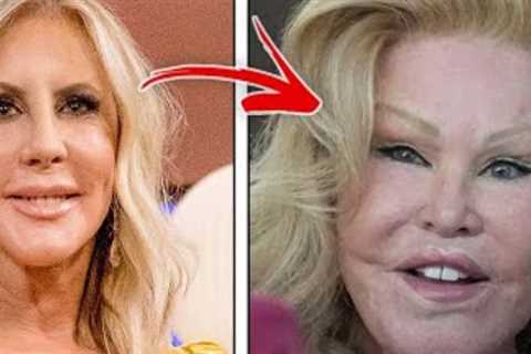 The Top 10 Celebrities Obsessed with Plastic Surgery Who Have Broken