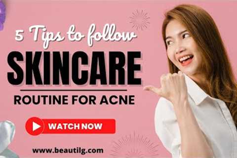 Best Skincare routine for Acne