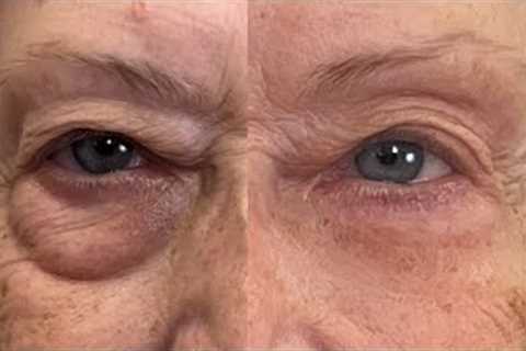 HOW TO GET RID OF EYE BAGS INSTANTLY | FIERCE AGING | Nikol Johnson