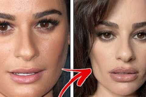 Celebrities' Faces: Top 10 Buccal Fat Removing Surgeries
