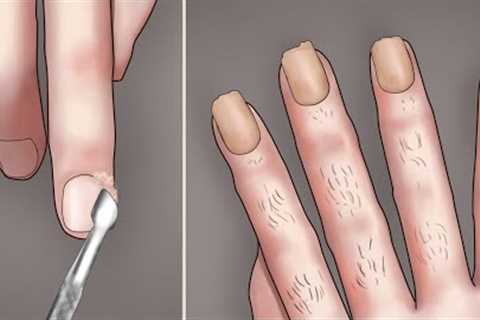 UGLY YELLOW NAILS TRANSFORMATION // ASMR Manicure process animation