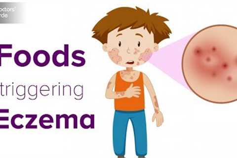 Foods triggering eczema flare up | Help your child avoid the itch! - Dr. Udhay Sidhu