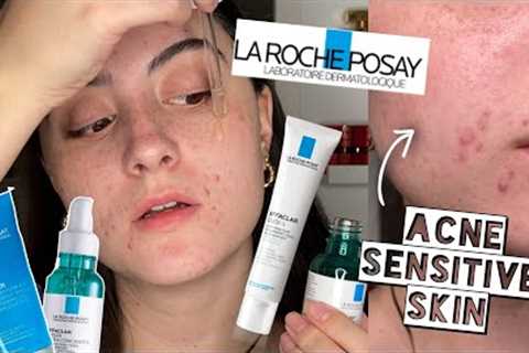 TESTING LA ROCHE POSAY EFFECLAR SKINCARE ROUTINE ON ACNE, SENSITIVE, DRY SKIN FOR 2 WEEKS