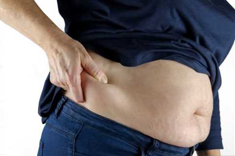 How Long Can an Overweight Person Live Without Food?