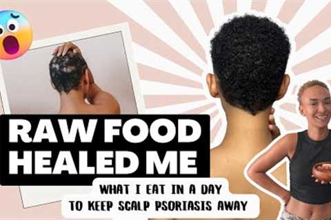 What I Eat In A Day 🫐 To Heal Psoriasis 🌱Simple Raw Vegan Recipes, Juicing, Smoothie Bowl+Salad