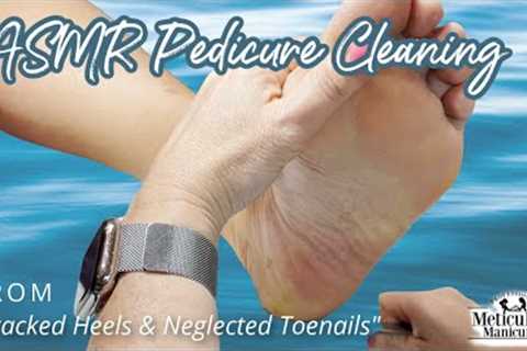 👣ASMR Pedicure Cleaning💆‍♀️Cracked Heels &amp; Neglected Toenails👣
