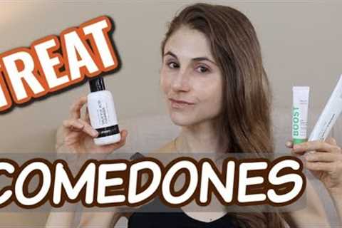 How to treat closed comedones: tips from a dermatologist| Dr Dray