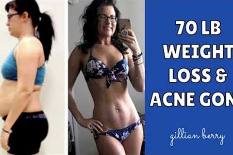 RAW VEGAN BEFORE &amp; AFTER TRANSFORMATION: 70LB WEIGHT LOSS, ACNE GONE | LISSA RAW FOOD ROMANCE