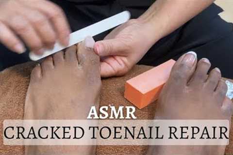 ASMR Cracked Toenail Repair | Pedicure ASMR