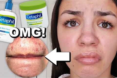 I Used Cetaphil Skincare For One Week!