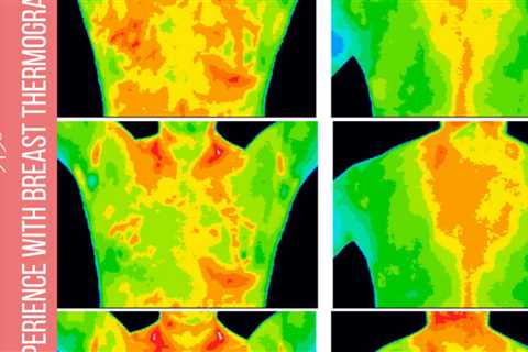 128: My experience with breast thermography
