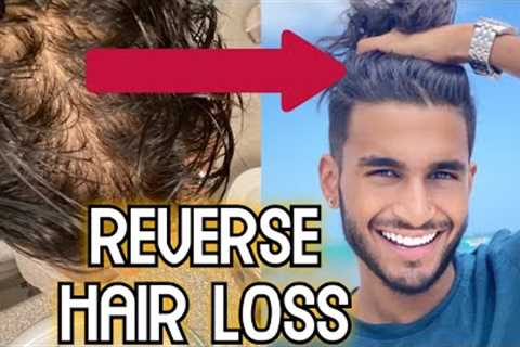 How to Reverse Hair Loss (4 Steps to STOP BALDING)