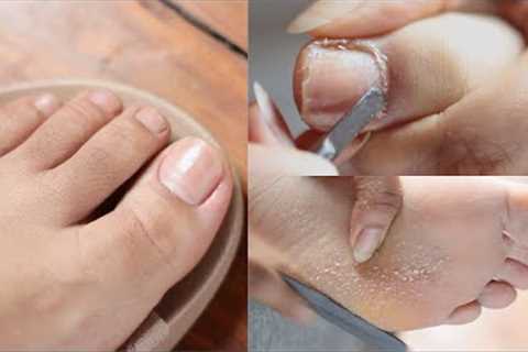 Relaxing DIY ASMR Pedicure Callus Feet | Water Sounds