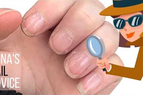 Is Builder Gel good for damaged nails? [Anna's Nail Advice]