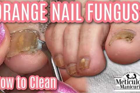 👣Pedicure for Men How to Clean Orange Nail Fungus Off Toenails👣